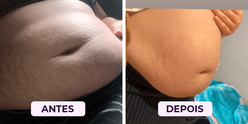 Antes-Depois