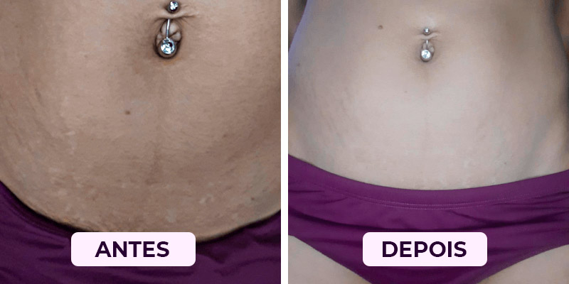 Antes-Depois2