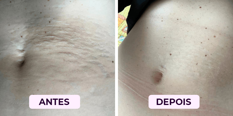 Antes-Depois3