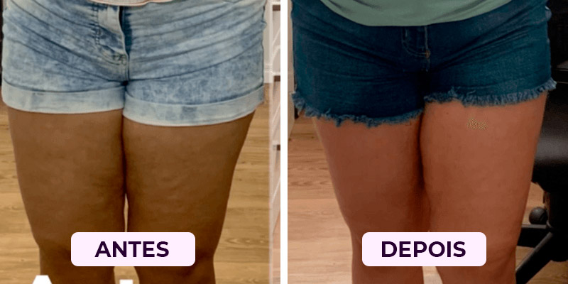 Antes-Depois4