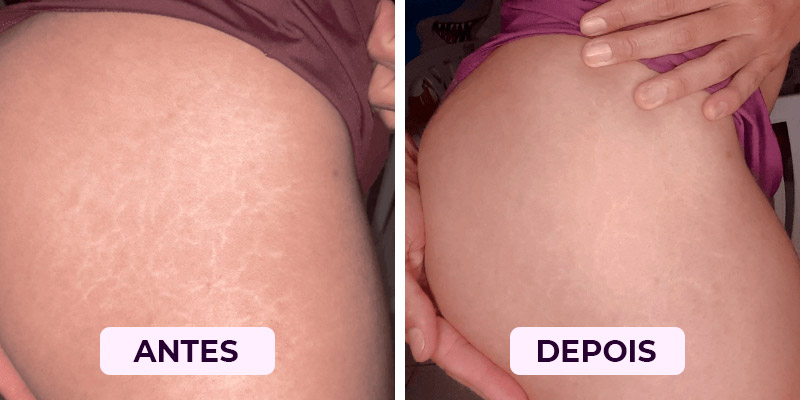 Antes-Depois5