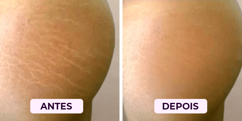 Antes-Depois6